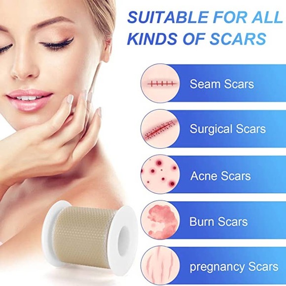 Silicone Scar Sheets (1.6” x 60”Roll-150cm) Scar Tape Reusable, Washable - Picture 3 of 7